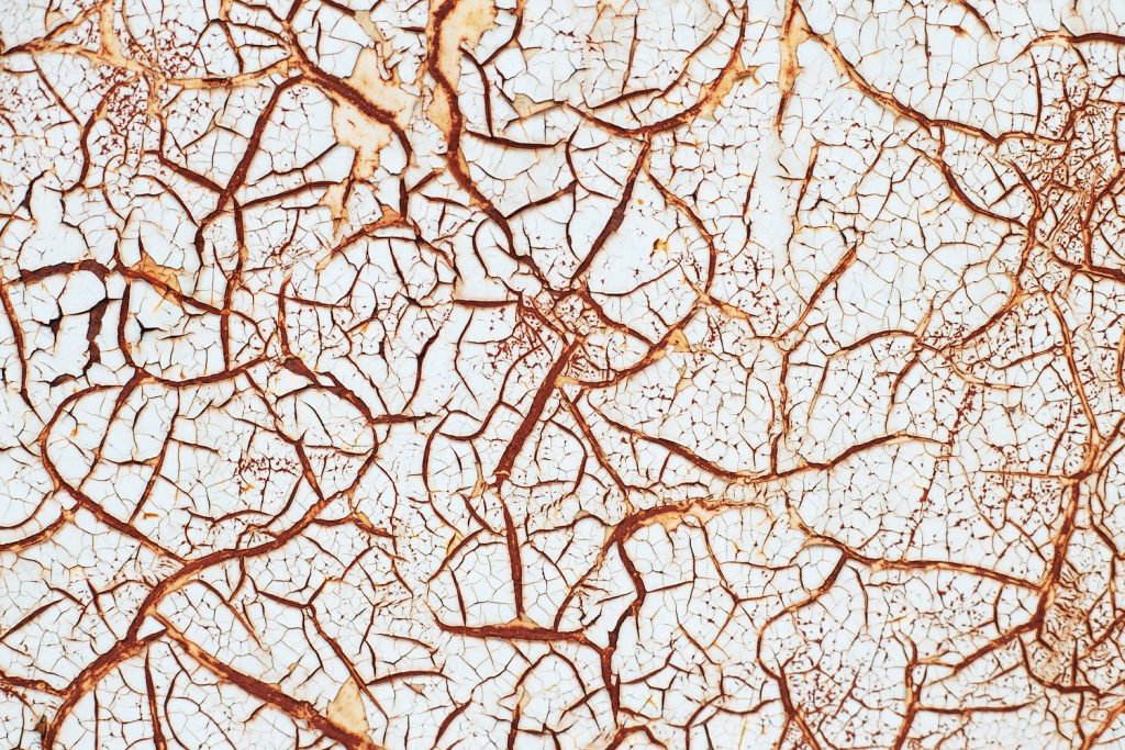 Spinal Musküler Atrofi’de Hidroterapi